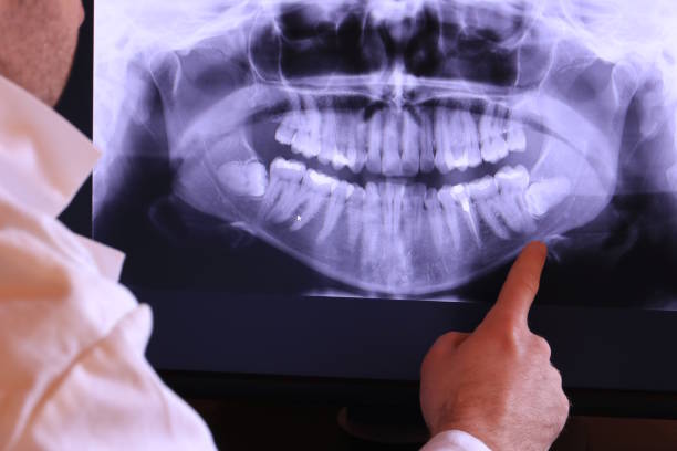 Best Emergency Tooth Extraction in Cascade Locks, OR